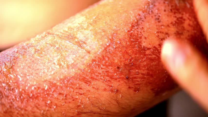 Close Up Of Lubrication Wound Healing Cream Extreme Macro Video Stock